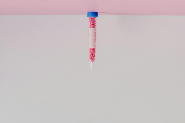 Comment choisir le lieu de vie parfait pour un parent atteint de la maladie d'Alzheimer ?